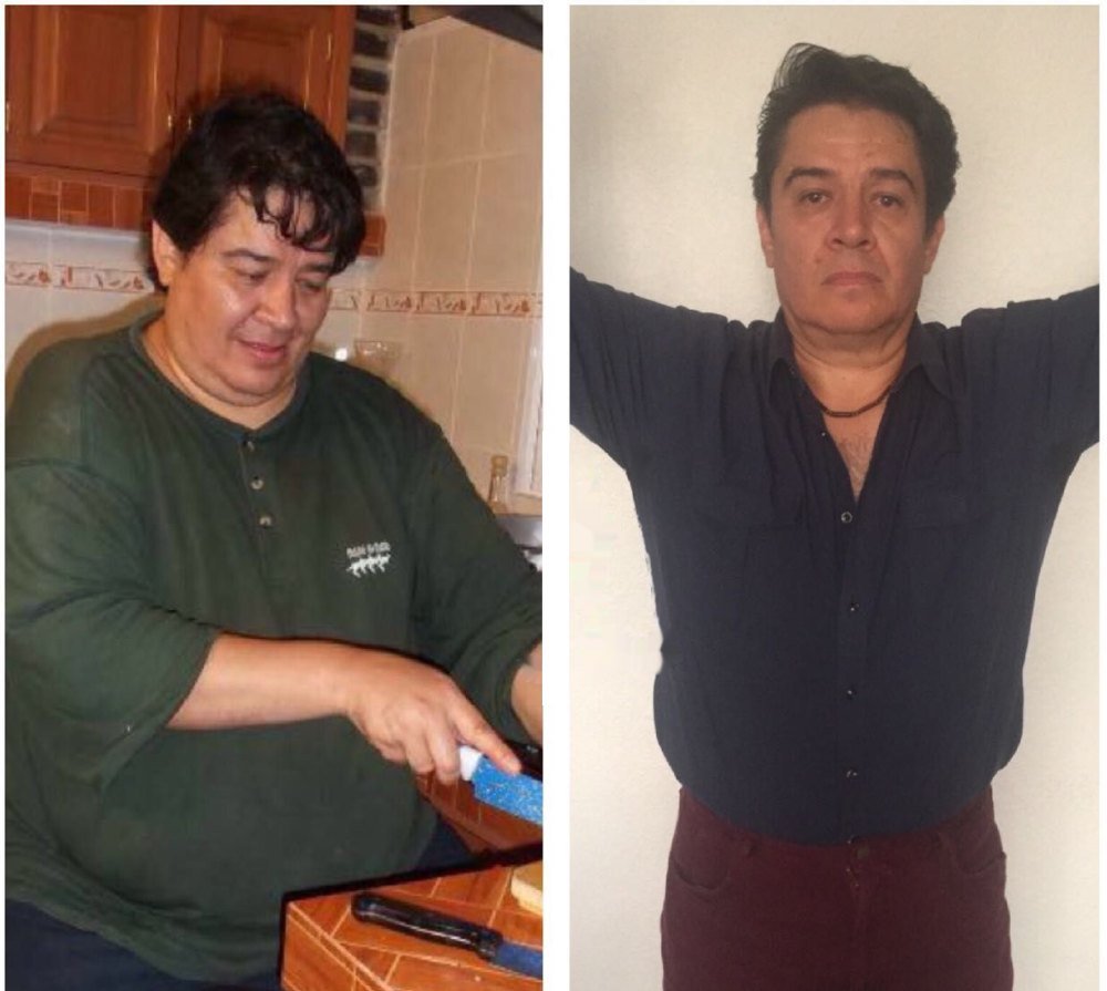Paciente de Haute antes y después de su programa