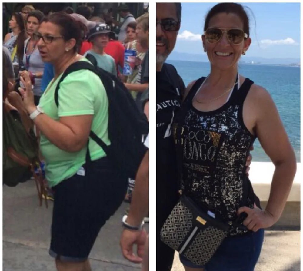 Paciente de Haute antes y después de su programa