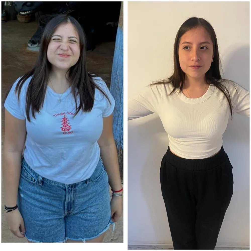 Paciente de Haute antes y después de su programa