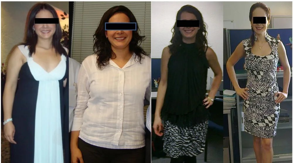 Paciente de Haute antes y después de su programa