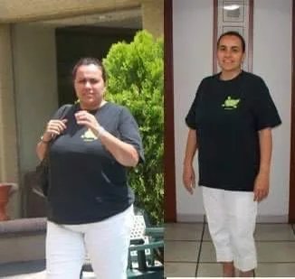 Paciente de Haute antes y después de su programa